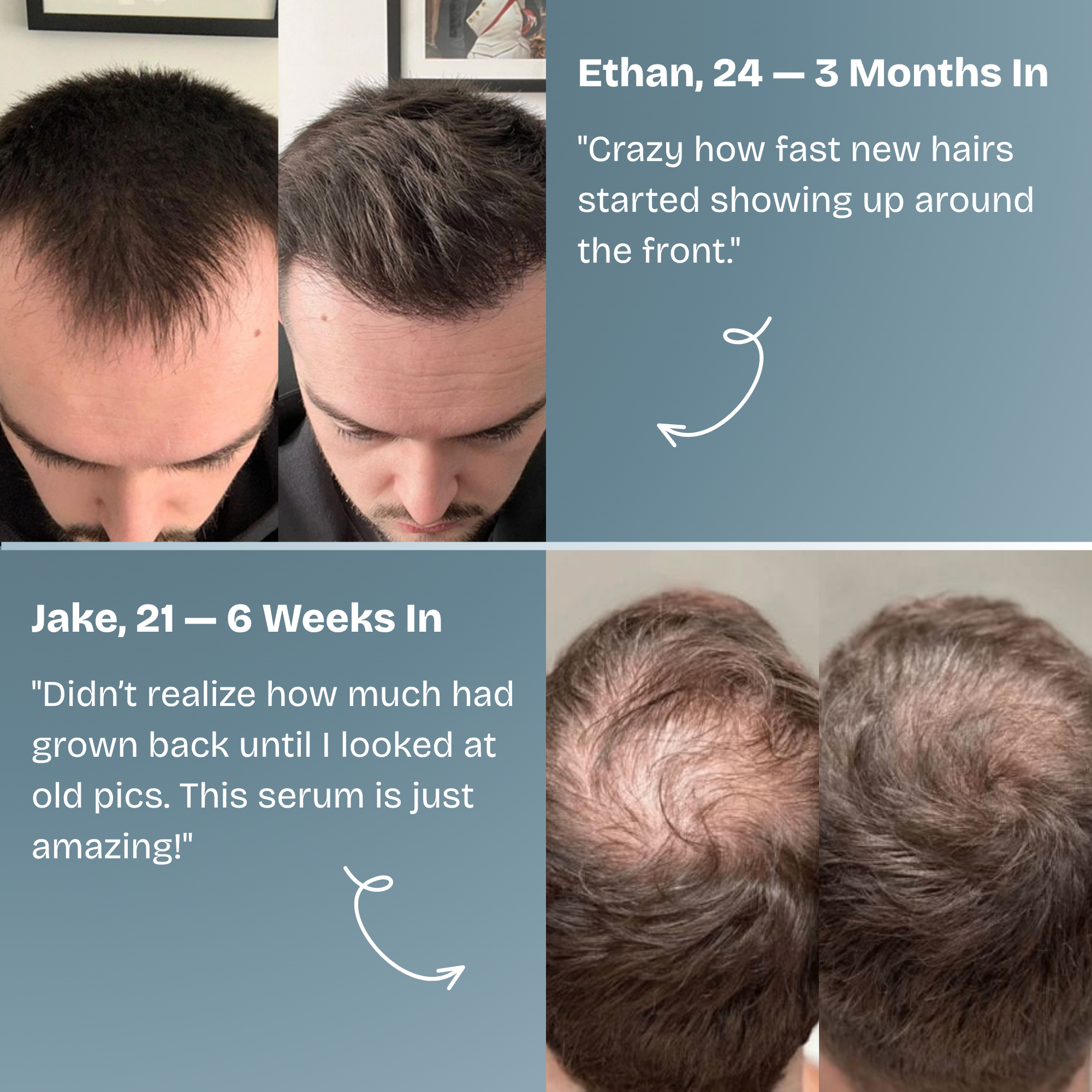 Hair Growth Serum Roll-On