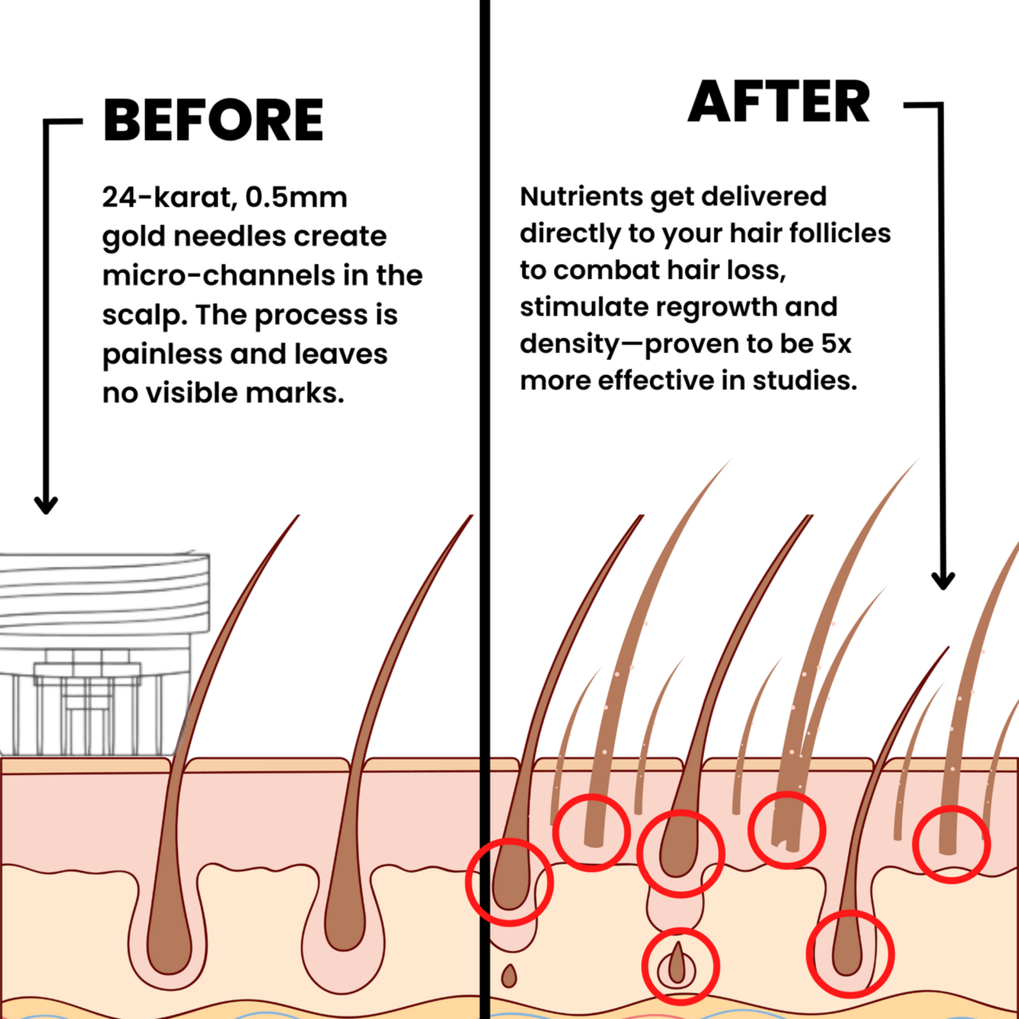 Hair Regrowth System